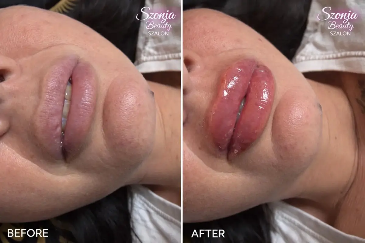 Szonja Beauty Salon – kezelés 25